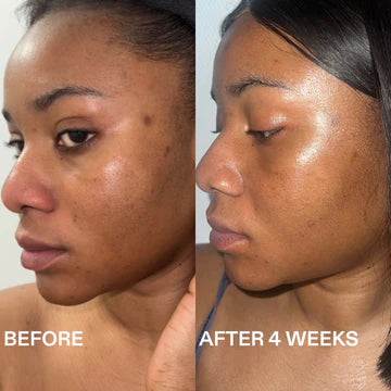Tone-Evening Tranexamic Acid Serum
